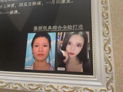 -佛山艺美医疗美容·整形·美肤·塑形