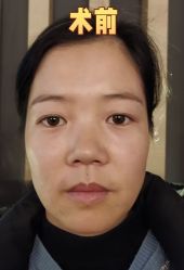 -素美医疗美容·西南眼鼻整形·修复基地
