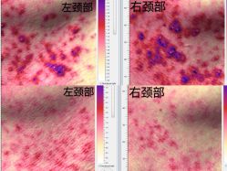 -皇族养心堂·净痘·修敏·御颜