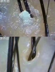 -润复丝·泽发防脱头皮管理