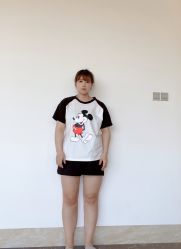 体验前-广东韩妃整形外科医院