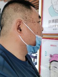 -痣清宫祛斑祛痣连锁店