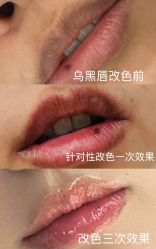 点击看大图 -杨益美学·野生眉半永久纹眉发际线