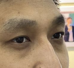 -天津健丽·去眼袋医疗美容机构