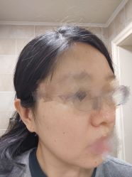 -小忠丽格医美