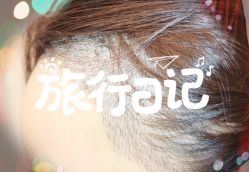 -大麦微针植发全国连锁