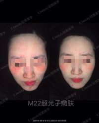 -E.beauty驻颜·痘敏肌调理中心