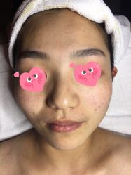 -皇族养心堂·净痘·修敏·御颜