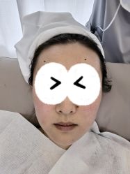 体验后-Dr.U博士医疗美容医院