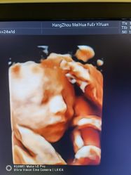 -杭州贝瑞斯美华妇儿医院·早孕·产检·儿科