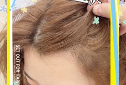 -大麦微针植发全国连锁