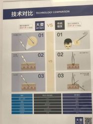 -大麦微针植发全国连锁