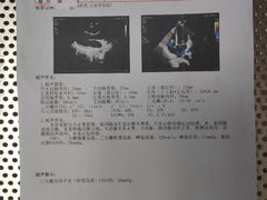 -东莞市人民医院(普济院区)
