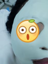 -蕾特恩专业祛痘国际连锁