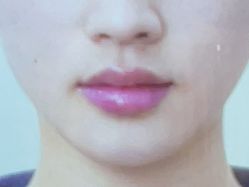 -美莱医疗美容医院