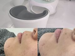 -上置·美兰优湖