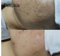 -Deeplus+韩国皮肤管理한국피부관리·C:Lab肌肤实验室