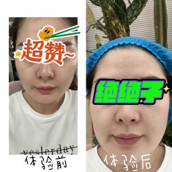 体验前-纯粹医美