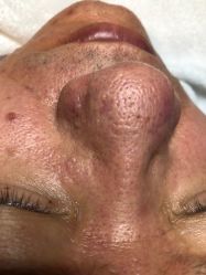 -SKIN MOLY魔力之肌皮肤管理中心