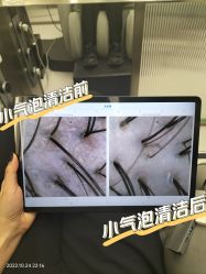 -润复丝·泽发防脱头皮管理