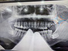 -同步齿科·数字化正畸种植口腔中心(珠海店)