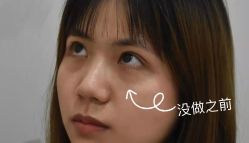 -天津健丽·去眼袋医疗美容机构