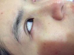 -晶奕空间专业脱毛连锁机构