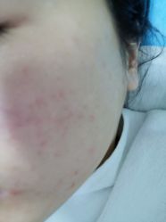 -北京丽星翼美医疗美容