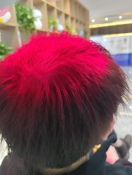 -碧莲盛·不剃发植发