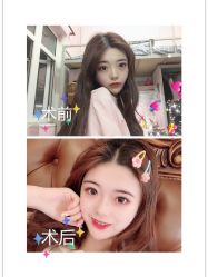 -广州美莱医疗美容医院