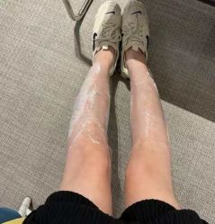 -安徽合肥韩美整形外科医院