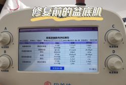-贝美佳产后修复中心