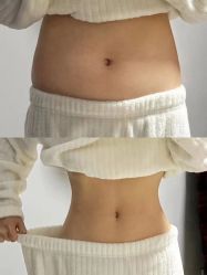 -香薇妮丝女子减肥院