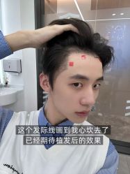 -雍禾植发全国连锁