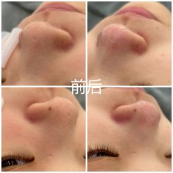 -skin79皮肤管理中心