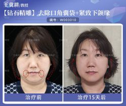 -丰联丽格医疗美容·联合丽格眼整形中心