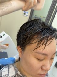 -大麦微针植发全国连锁