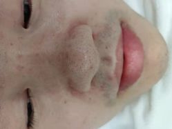 -蕾特恩专业祛痘·皮肤管理