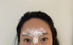 -四川米兰柏羽医学美容医院
