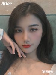 点击看大图 -重庆军科整形美容医院