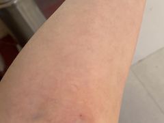 -山东第一医科大学第三附属医院