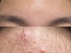 -上置·美兰优湖