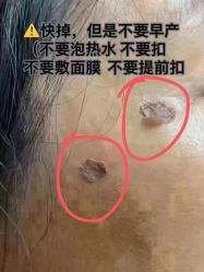 -万阡国际专业祛斑·祛痣·祛疤连锁