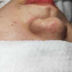 -苑苑vbeauty科技美容SPA