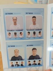 -极客侠男士假发定制补发