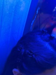 -碧莲盛·不剃发植发