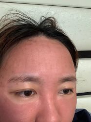 体验后-亿美医疗美容·半岛大超炮官方授权店