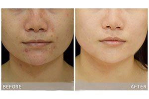 -SKINIST丽铂医疗美容