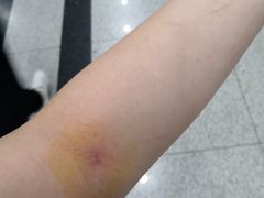 -杭州市第三人民医院