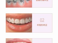 -优速得3D打印店(朝阳店)